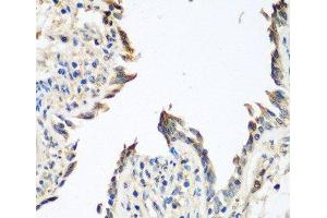 Immunohistochemistry of paraffin-embedded Human lung using GPI Polyclonal Antibody at dilution of 1:100 (40x lens).