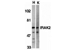 Western Blotting (WB) image for anti-Interleukin-1 Receptor-Associated Kinase 2 (IRAK2) antibody (ABIN1030204) (IRAK2 anticorps)