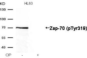 Western blot analysis of extracts from HL60 cells, treated with calf intestinal phosphatase (CIP), using Zap-70 (Phospho-Tyr319) Antibody. (ZAP7 (pTyr319) anticorps)