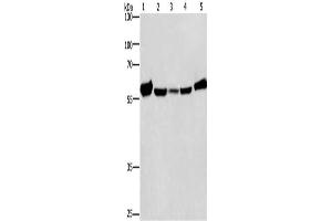 Gel: 8 % SDS-PAGE, Lysate: 40 μg, Lane 1-5: Mouse liver tissue, Raji cells, hela cells, hepG2 cells, A549 cells, Primary antibody: ABIN7128790(CAT Antibody) at dilution 1/266. (Catalase anticorps)
