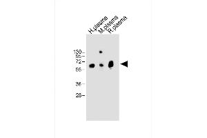 All lanes : Anti-T Antibody (Center) at 1:2000 dilution Lane 1: Human plasma whole lysate Lane 2: Mouse plasma whole lysate Lane 3: Rat plasma whole lysate Lysates/proteins at 20 μg per lane. (PLAT anticorps  (AA 371-399))