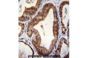 Immunohistochemistry (IHC) image for anti-SHQ1 Homolog (SHQ1) antibody (ABIN2996338) (SHQ1 anticorps)