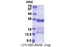 SDS-PAGE (SDS) image for G Antigen 2A (GAGE2A) (AA 1-116) protein (His tag) (ABIN5853252)