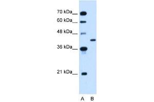 GOT2 antibody used at 2. (GOT2 anticorps)
