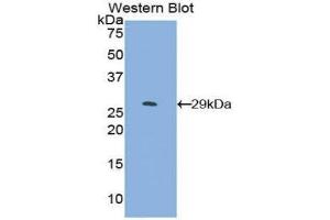 Western Blotting (WB) image for anti-SMAD Family Member 4 (SMAD4) (AA 323-552) antibody (ABIN1860591) (SMAD4 anticorps  (AA 323-552))