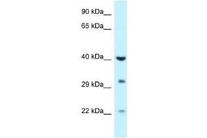 Western Blot showing GALK1 antibody used at a concentration of 1 ug/ml against Fetal Liver Lysate (GALK1 anticorps  (C-Term))