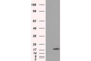 Image no. 6 for anti-Crystallin, alpha B (CRYAB) antibody (ABIN1497647)