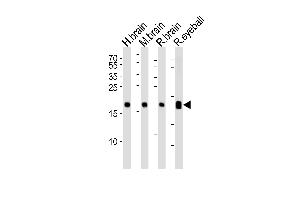 Western blot analysis of lysates from human brain, mouse brain, rat brain and rat eyeball tissue lysate (from left to right), using VILIP1 Antibody at 1:1000 at each lane. (VSNL1 anticorps  (C-Term))