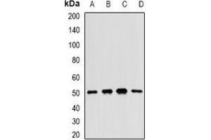 Western blot analysis of MKK5 expression in H460 (A), BT474 (B), mouse liver (C), rat kidney (D) whole cell lysates. (MAP2K5 anticorps)