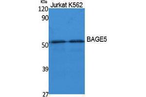 BAGE5 anticorps  (N-Term)