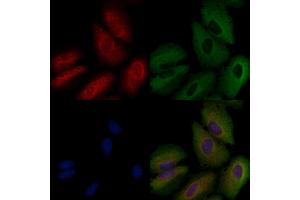 ABIN6258783 and ABIN6274160 staining  cells by IF/ICC.