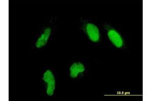 Immunofluorescence of monoclonal antibody to GLTSCR2 on HeLa cell. (GLTSCR2 anticorps  (AA 402-478))