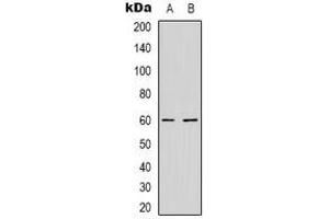 Western blot analysis of NXF3 expression in HepG2 (A), MCF7 (B) whole cell lysates. (NXF3 anticorps)