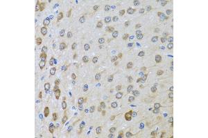 Immunohistochemistry of paraffin-embedded rat brain using BTD antibody (ABIN5973709) at dilution of 1/100 (40x lens). (BTD anticorps)