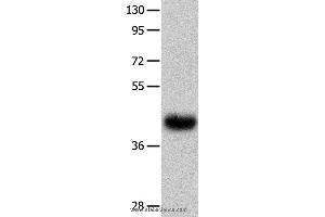 Western blot analysis of Human fetal muscle tissue  , using UTS2R Polyclonal Antibody at dilution of 1:400 (UTS2R anticorps)
