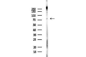 anti-Ribonucleoprotein, PTB-Binding 2 (RAVER2) antibody
