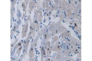 Used in DAB staining on fromalin fixed paraffin- embedded heart tissue (TOP3B anticorps  (AA 1-250))