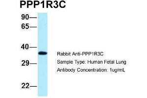Host: Rabbit  Target Name: PPP1R3C  Sample Tissue: Human Fetal Lung  Antibody Dilution: 1. (PPP1R3C anticorps  (N-Term))