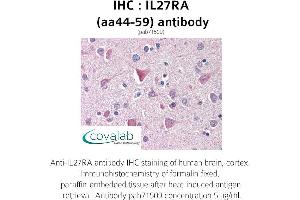Image no. 1 for anti-Interleukin 27 Receptor, alpha (IL27RA) (AA 44-59) antibody (ABIN1735897) (IL27 Receptor alpha anticorps  (AA 44-59))