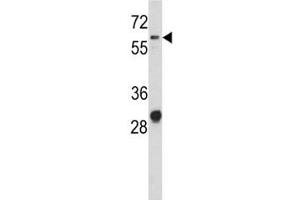Western blot analysis of CD166 antibody and NCI-H460 lysate.