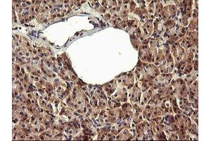 Image no. 3 for anti-Peptidyl Arginine Deiminase, Type IV (PADI4) (AA 299-588) antibody (ABIN1491356)