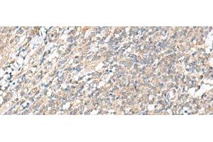 Immunohistochemistry of paraffin-embedded Human tonsil tissue using WDR47 Polyclonal Antibody at dilution of 1:35(x200) (WDR47 anticorps)