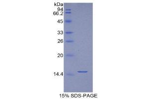 SDS-PAGE (SDS) image for Biglycan (BGN) (AA 242-369) protein (His tag) (ABIN1169940)