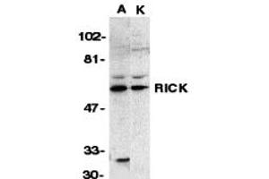 Western Blotting (WB) image for anti-Receptor-Interacting Serine-threonine Kinase 2 (RIPK2) (N-Term) antibody (ABIN1031540) (RIPK2 anticorps  (N-Term))