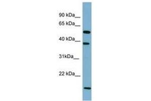 Image no. 1 for anti-Solute Carrier Family 10 (Sodium/bile Acid Cotransporter Family), Member 1 (SLC10A1) (AA 107-156) antibody (ABIN6741685) (SLC10A1 anticorps  (AA 107-156))