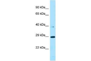 WB Suggested Anti-PROCA1 Antibody Titration: 1. (PROCA1 anticorps  (C-Term))