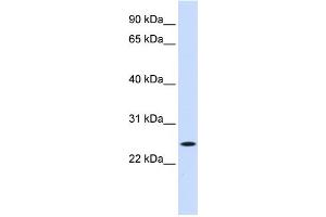 WB Suggested Anti-NOL3 Antibody Titration:  0. (NOL3 anticorps  (Middle Region))