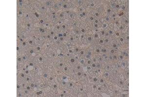 Used in DAB staining on fromalin fixed paraffin- embedded liver tissue