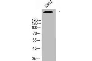 Western Blot analysis of K562 cells using Talin-1 Polyclonal Antibody (TLN1 anticorps  (C-Term))