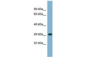 PRKRIP1 anticorps  (N-Term)