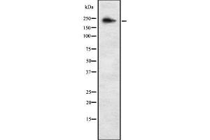 Western blot analysis of ALPK3 using K562 whole cell lysates (ALPK3 anticorps  (C-Term))