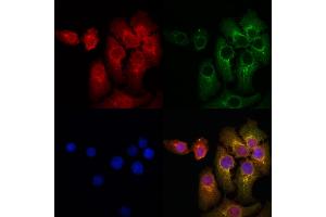 ABIN6259451 and ABIN6274942 staining Hela cells by IF/ICC.
