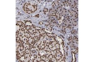 Immunohistochemical staining of human pancreas with CSDC2 polyclonal antibody  shows strong nuclear positivity in both exocrine glandular cells and Islet cells. (CSDC2 anticorps)