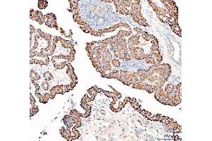 IHC analysis of PPA2 using anti-PPA2 antibody (ABIN6719431). (PPA2 anticorps  (AA 33-334))