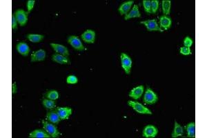Immunofluorescent analysis of PC-3 cells using ABIN7144259 at dilution of 1:100 and Alexa Fluor 488-congugated AffiniPure Goat Anti-Rabbit IgG(H+L)