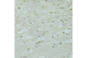 Immunohistochemistry of paraffin-embedded mouse brain using RCC1 antibody. (RCC1 anticorps  (AA 1-240))