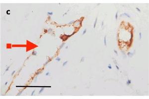 IHC Validation of Envelope in COVID-19 Patient Skin: (Magro et al. (SARS-CoV-2 Envelope anticorps  (N-Term))