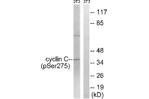 Immunohistochemistry analysis of paraffin-embedded human breast carcinoma tissue using Cyclin C (Phospho-Ser275) antibody. (Cyclin C anticorps  (pSer275))