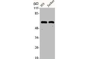 Western Blot analysis of NIH-3T3 Jurkat cells using Cytokeratin 10 Polyclonal Antibody