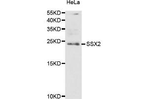 Western blot analysis of extracts of HeLa cells, using SSX2 antibody (ABIN5974203) at 1/1000 dilution. (SSX2 anticorps)
