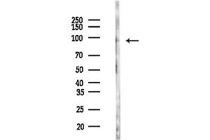 anti-Very Low Density Lipoprotein Receptor (VLDLR) (N-Term) antibody