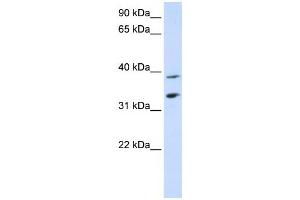 Western Blotting (WB) image for anti-Solute Carrier Family 25, Member 34 (SLC25A34) antibody (ABIN2458822) (SLC25A34 anticorps)