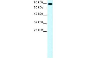 WB Suggested Anti-C13ORF8 Antibody Titration: 1. (ZNF828 anticorps  (Middle Region))