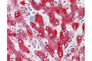 Human, Liver: Formalin-Fixed Paraffin-Embedded (FFPE)