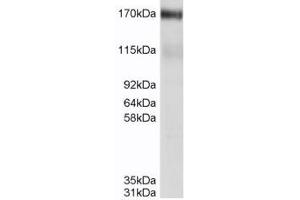 ABCC4 anticorps  (C-Term)