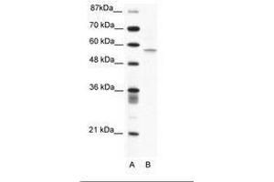 Image no. 1 for anti-Programmed Cell Death 4 (PDCD4) (N-Term) antibody (ABIN203165) (PDCD4 anticorps  (N-Term))